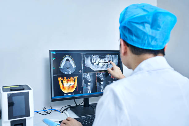 Best Emergency Wisdom Teeth Removal in Morrisville, NC